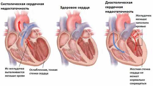 Регулярное повышение