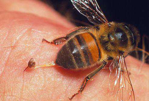 Укусила пчела: что делать